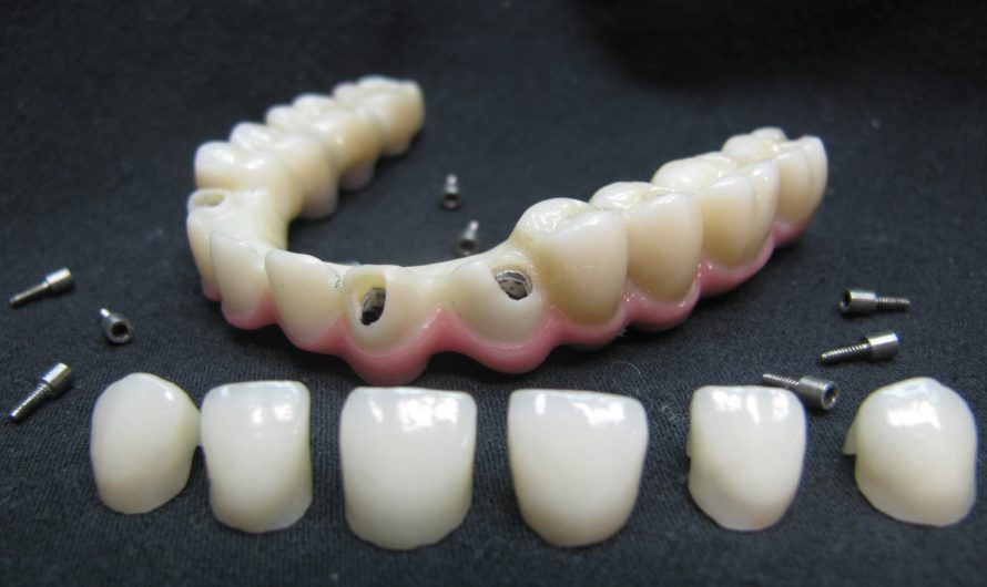 Революция в реставрации зубов: производство циркониевых коронок